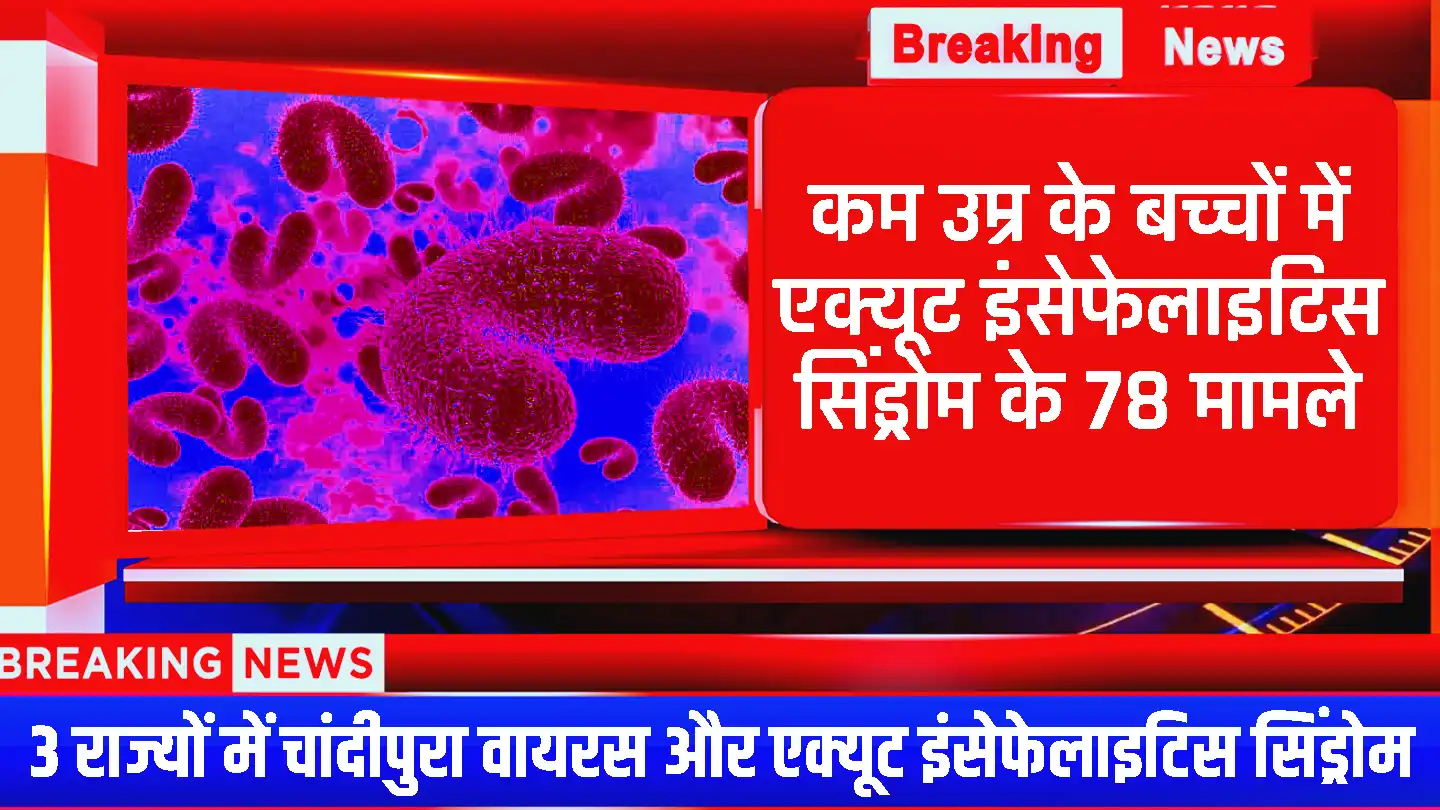 Chandipura Virus: कम उम्र के बच्चों में एक्यूट इंसेफेलाइटिस सिंड्रोम के 78 मामले, 76 नमूनों में से नौ में चांदीपुरा वायरस